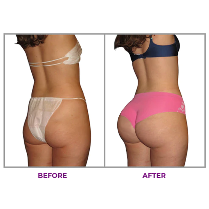 ❣️LIMETOW™ Hip Plump Capric Oil