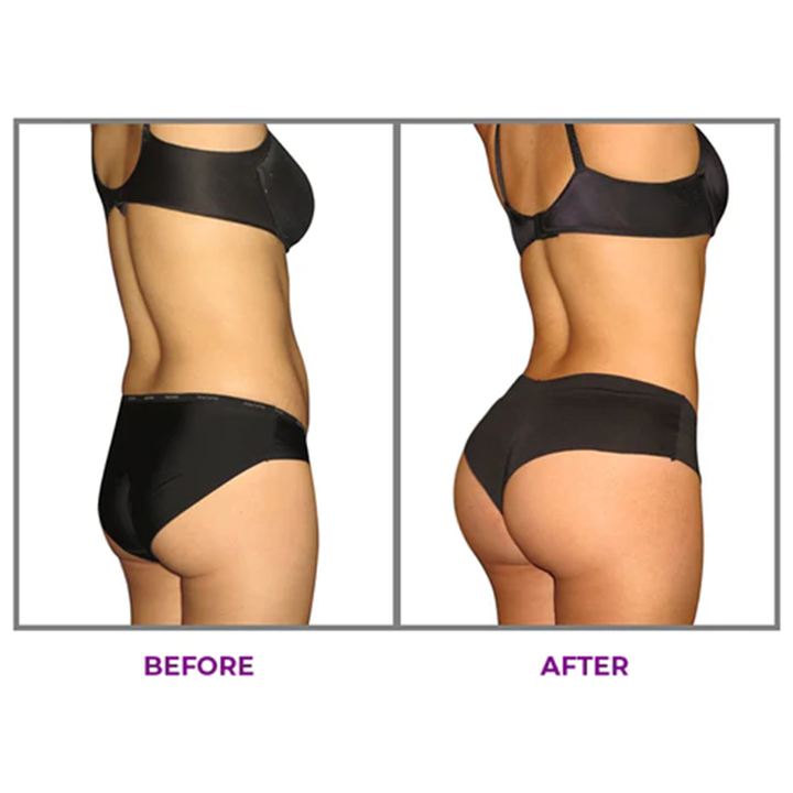 ❣️LIMETOW™ Hip Plump Capric Oil