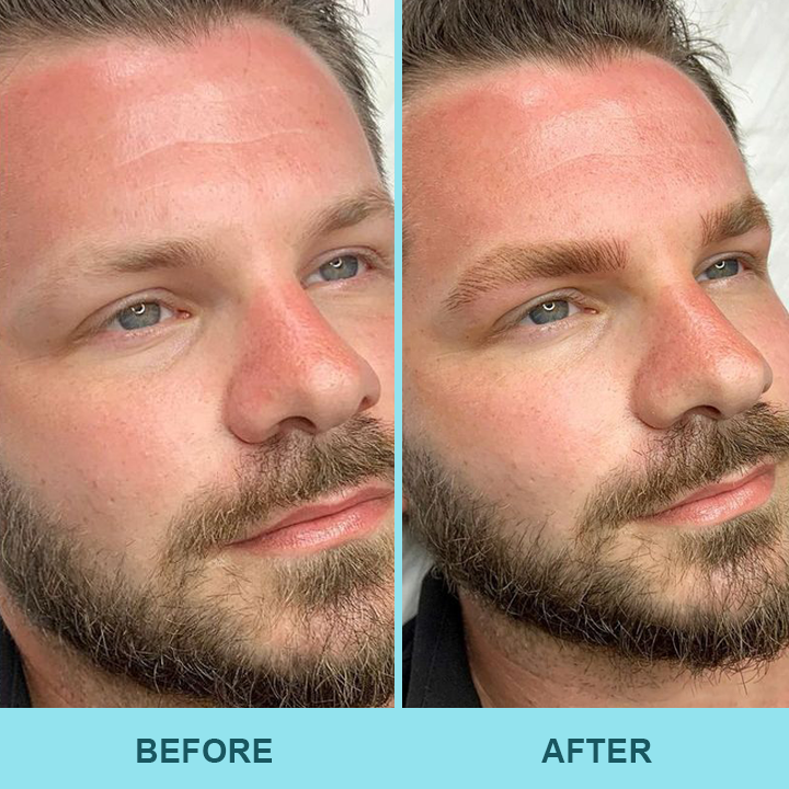 ✨Last Day Discount:80% OFF🔥 LIMETOW™ Eyebrow Essence