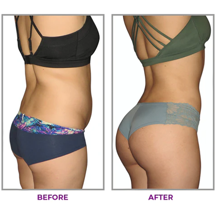 ❣️LIMETOW™ Hip Plump Capric Oil