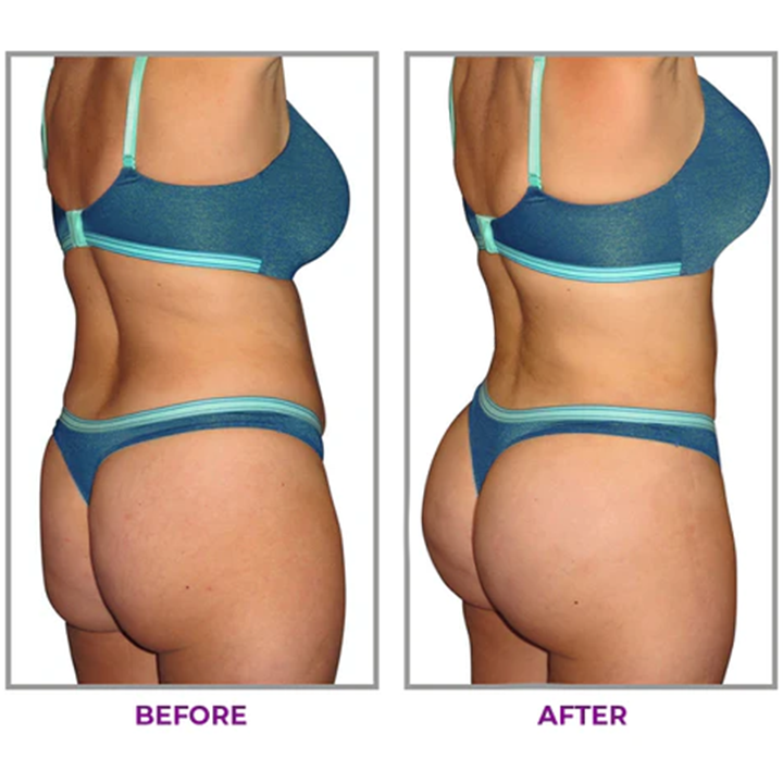 ❣️LIMETOW™ Hip Plump Capric Oil