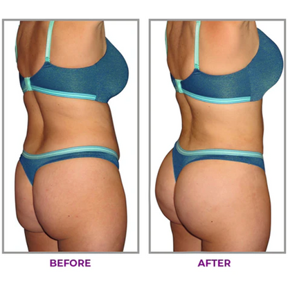 ❣️LIMETOW™ Hip Plump Capric Oil