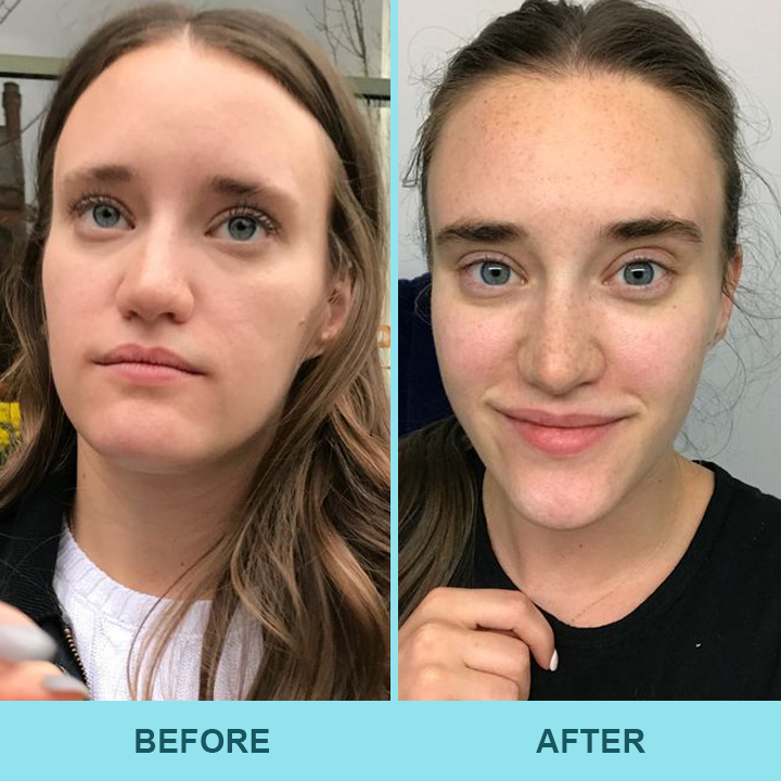✨Last Day Discount：80% OFF🔥 LIMETOW® Eyebrow Essence