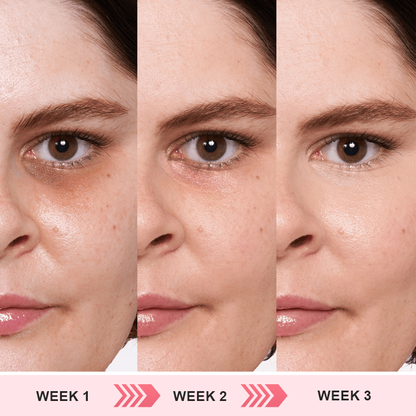 LIMETOW™ Retinol Eye Stick✅ for Reduces Fine Lines，Puffiness and Dark Circles🌟