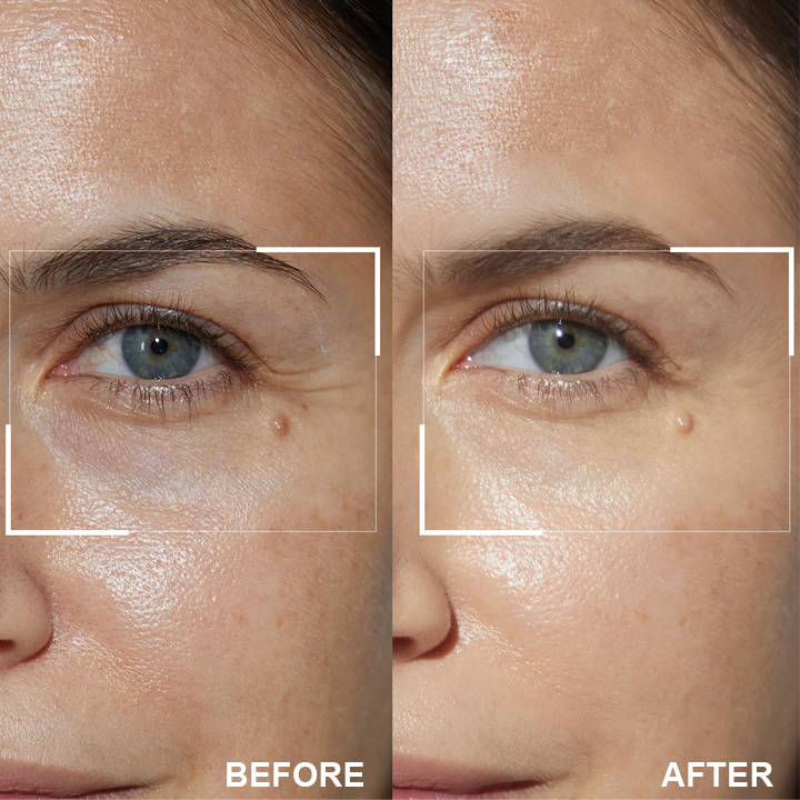 LIMETOW™ Retinol Eye Stick✅ for Reduces Fine Lines，Puffiness and Dark Circles🌟