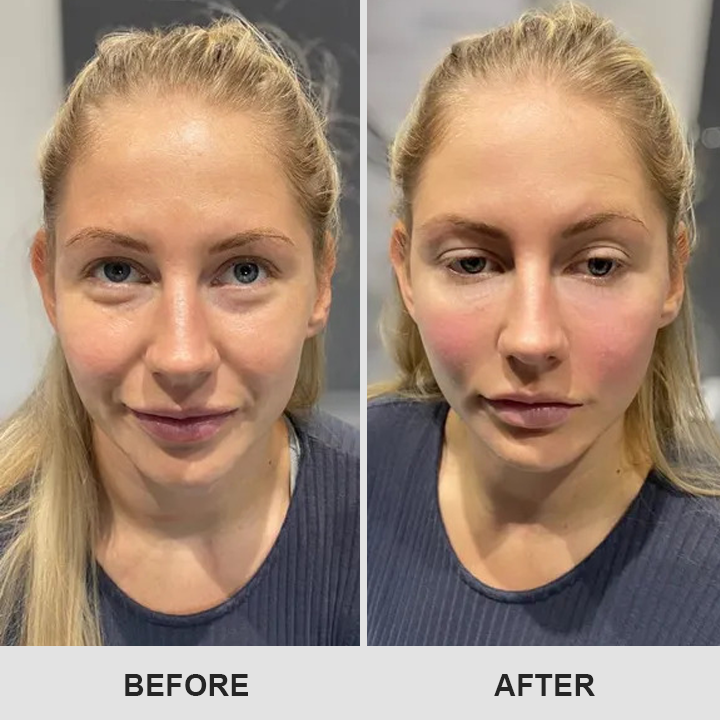 LIMETOW™ Retinol Eye Stick✅ for Reduces Fine Lines，Puffiness and Dark Circles🌟