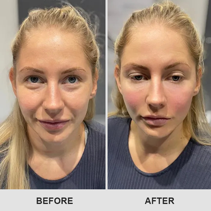 LIMETOW™ Retinol Eye Stick✅ for Reduces Fine Lines，Puffiness and Dark Circles🌟