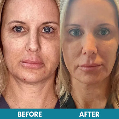 LIMETOW™ LuxeLift Skin Firming Youth Butter